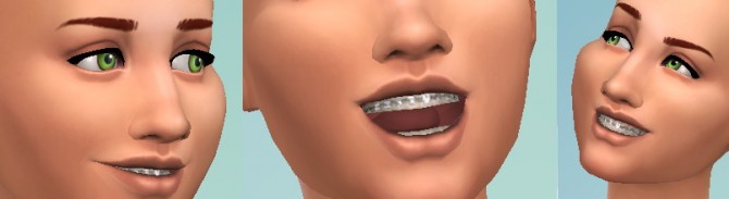 Sims 4 Braces at Jongarakun’s Junk