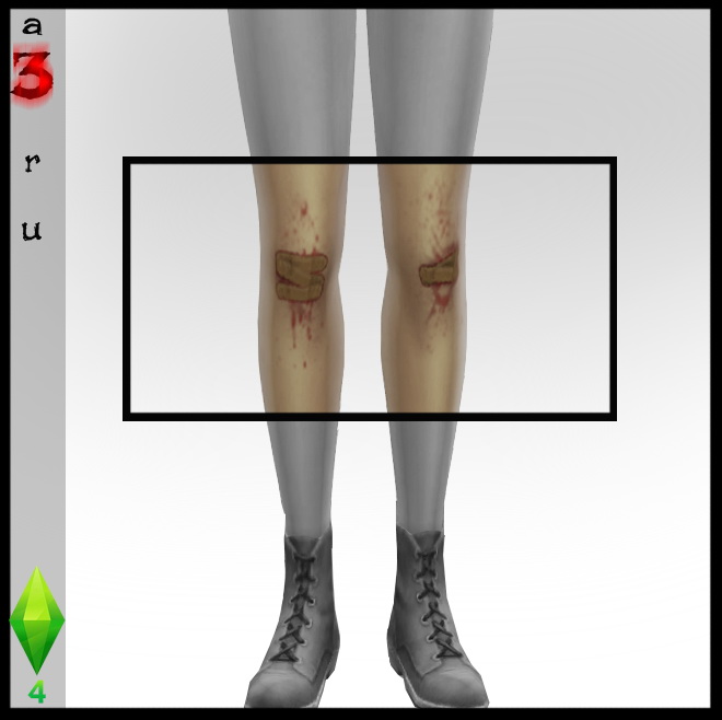 Sims 4 Scraped/Bloody knees with bandaids at A3RU