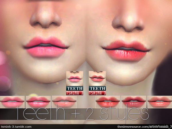 Sims 4 Teeth (2 styles) by tsminh 3 at TSR