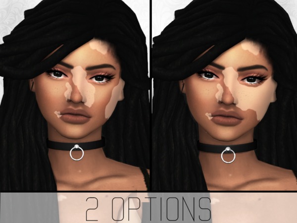 Sims 4 Vitiligo Overlay by SimplyPixelated at TSR