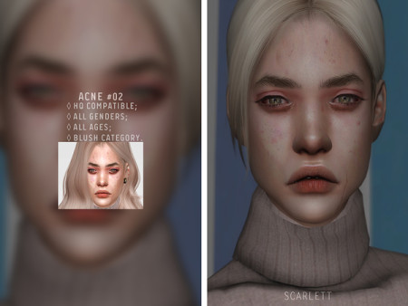 Acne #02 by Scarlett-content at TSR