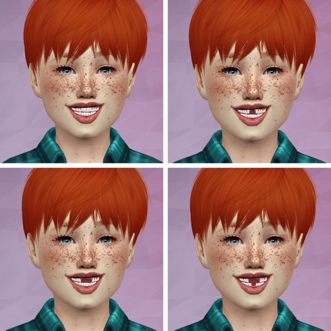 Sims 4 3D REALISTIC TEETH CHILD VERSION by Thiago Mitchell at REDHEADSIMS