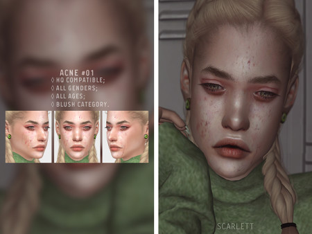 Acne #01 by Scarlett-content at TSR