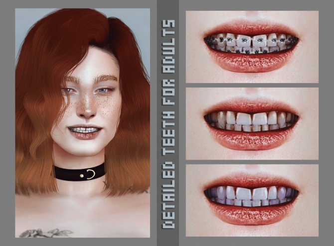 Detailed teeth A at Magic-bot » Sims 4 Updates