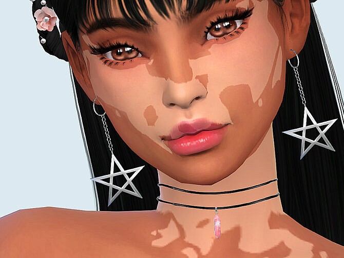 Sims 4 Skin Detail Vitiligo Set No. 2 by Saruin at TSR