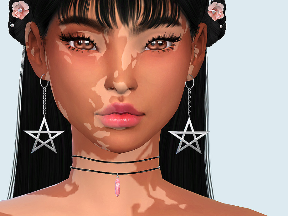 Sims 3 Vitiligo Skin