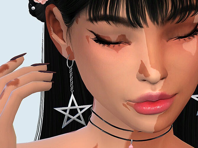 Sims 4 Skin Detail Vitiligo Set No. 2 by Saruin at TSR
